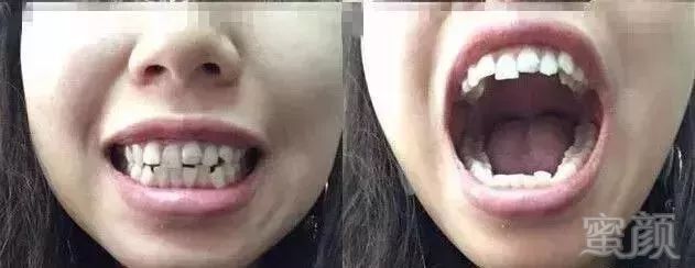 https://img.miyanlife.com/mnt/timg/180104/13303a2F-10.jpg