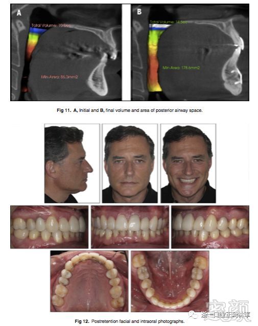 https://img.miyanlife.com/mnt/timg/180105/1045331N1-7.jpg