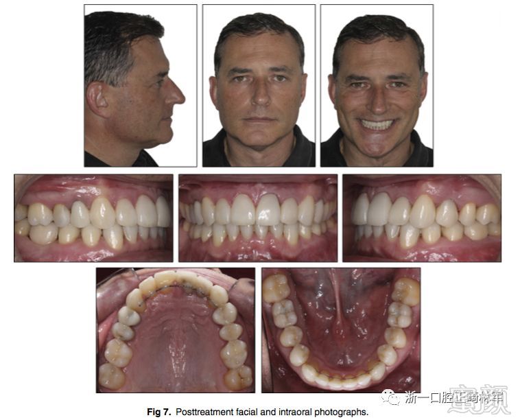 https://img.miyanlife.com/mnt/timg/180105/1045334S5-5.jpg