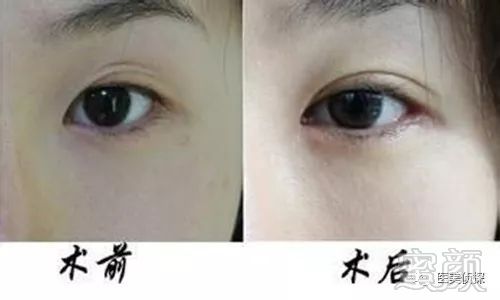 https://img.miyanlife.com/mnt/timg/180105/1205046338-0.jpg