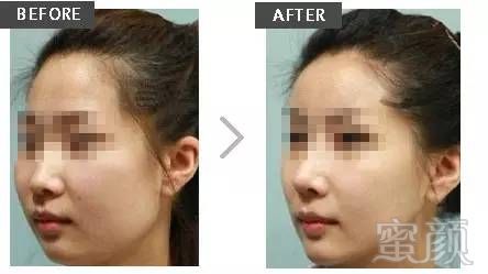 https://img.miyanlife.com/mnt/timg/180105/122TL412-4.jpg