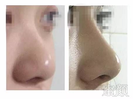 https://img.miyanlife.com/mnt/timg/180105/122TLK0-5.jpg