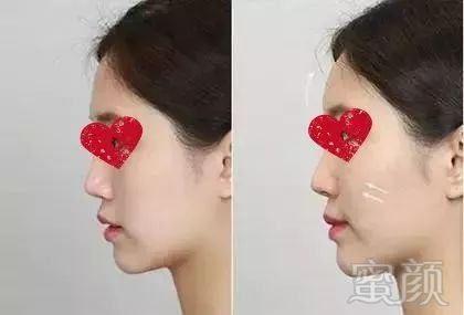 https://img.miyanlife.com/mnt/timg/180105/1239353N5-1.jpg