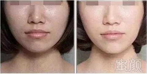 https://img.miyanlife.com/mnt/timg/180105/12393B624-2.jpg