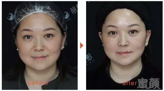 https://img.miyanlife.com/mnt/timg/180105/124551O01-2.jpg