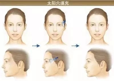 https://img.miyanlife.com/mnt/timg/180105/12515MZ5-2.jpg