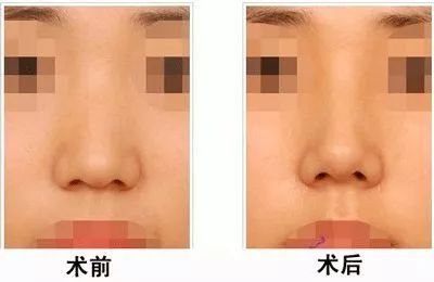 https://img.miyanlife.com/mnt/timg/180105/12515T421-3.jpg