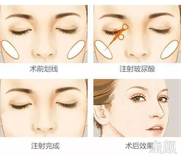 https://img.miyanlife.com/mnt/timg/180105/12515Wc4-6.jpg