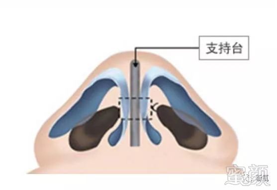 案例图片