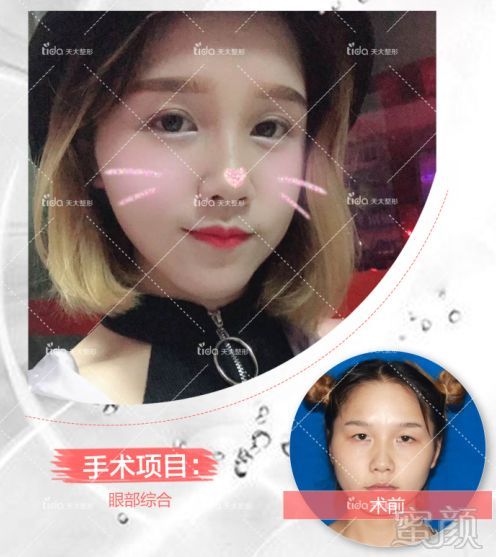 https://img.miyanlife.com/mnt/timg/180105/140Z44039-9.jpg