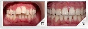 https://img.miyanlife.com/mnt/timg/180106/11160051L-1.jpg