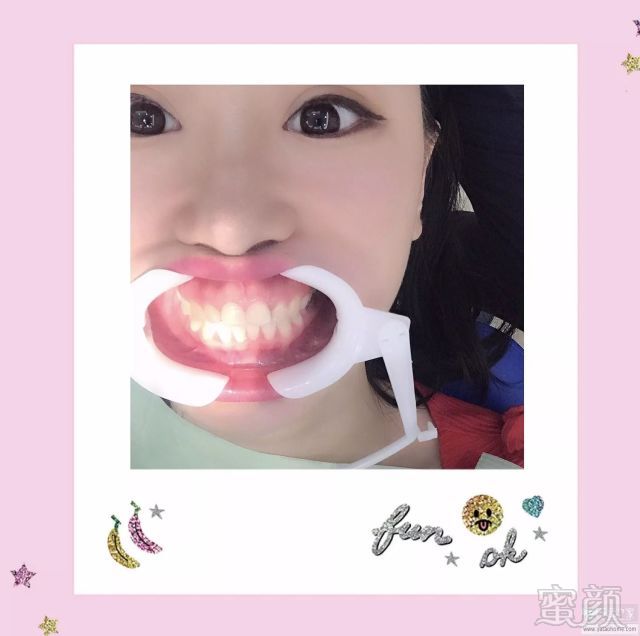 https://img.miyanlife.com/mnt/timg/180106/120Z92c6-2.jpg