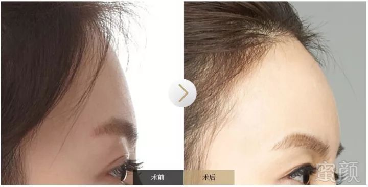 https://img.miyanlife.com/mnt/timg/180106/1216361012-4.jpg