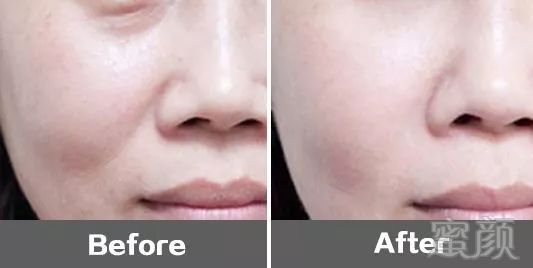 https://img.miyanlife.com/mnt/timg/180106/1216361121-5.jpg