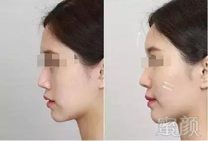 https://img.miyanlife.com/mnt/timg/180106/1216362213-6.jpg