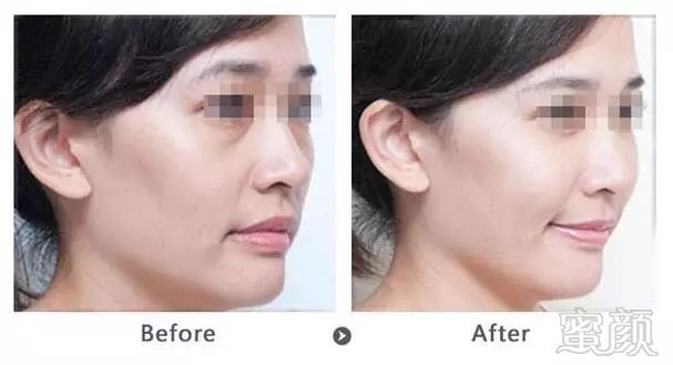 https://img.miyanlife.com/mnt/timg/180106/1216364040-8.jpg