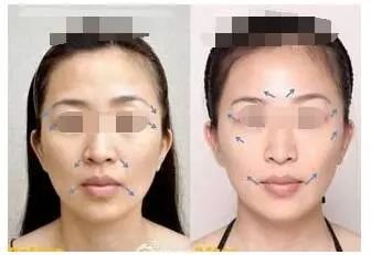 https://img.miyanlife.com/mnt/timg/180106/12163G3M-9.jpg