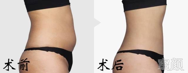 https://img.miyanlife.com/mnt/timg/180106/12595221S-1.jpg