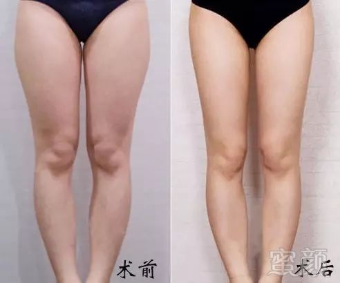 https://img.miyanlife.com/mnt/timg/180106/1259523207-4.jpg
