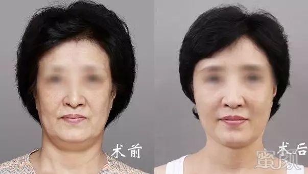 https://img.miyanlife.com/mnt/timg/180106/1300034a8-12.jpg