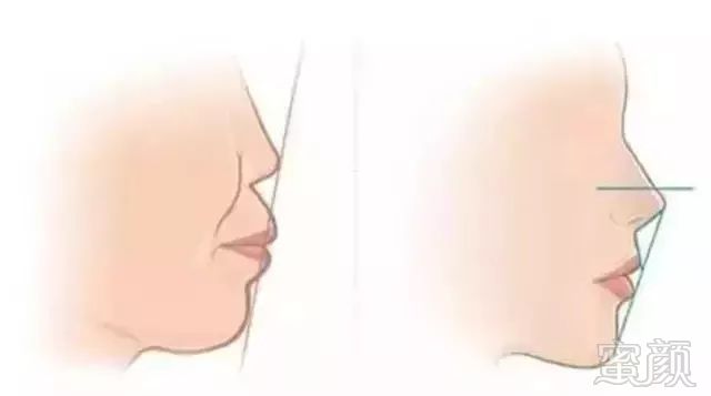 https://img.miyanlife.com/mnt/timg/180106/1314492T6-3.jpg