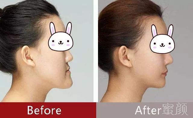 https://img.miyanlife.com/mnt/timg/180106/131449C24-2.jpg