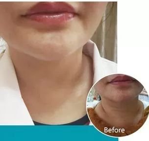 https://img.miyanlife.com/mnt/timg/180106/133F52644-1.jpg