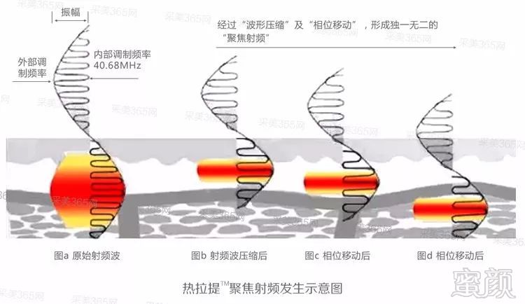 案例图片