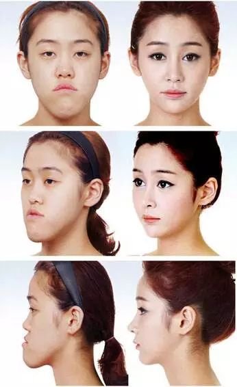https://img.miyanlife.com/mnt/timg/180107/103KHb1-2.jpg