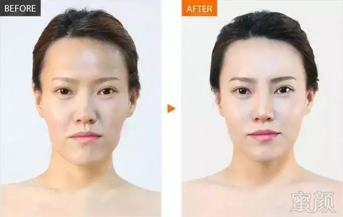 https://img.miyanlife.com/mnt/timg/180107/104033K44-3.jpg