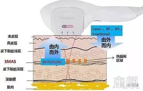 案例图片