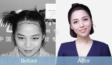 https://img.miyanlife.com/mnt/timg/180107/1210263W6-8.jpg