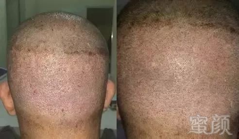 https://img.miyanlife.com/mnt/timg/180107/1219142R4-5.jpg