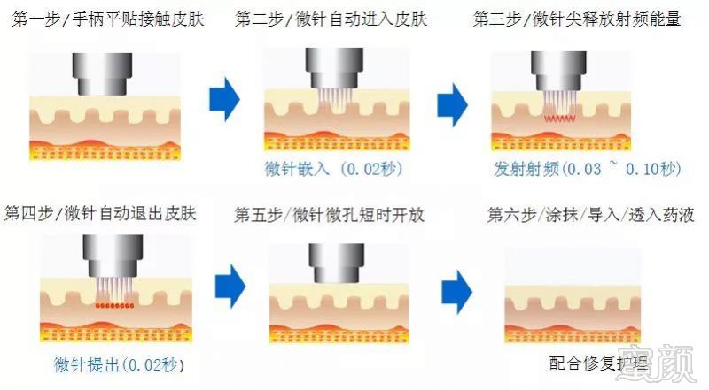 https://img.miyanlife.com/mnt/timg/180107/12523S020-2.jpg