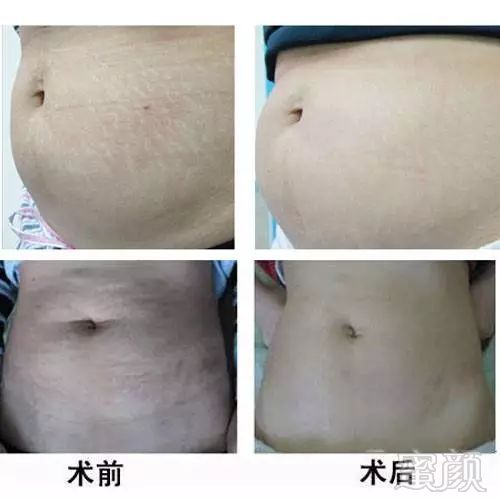 https://img.miyanlife.com/mnt/timg/180107/12523U023-6.jpg