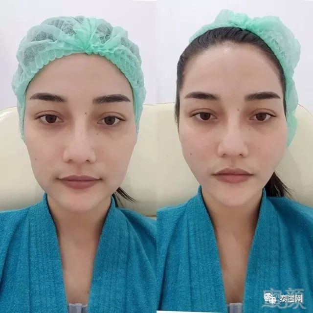https://img.miyanlife.com/mnt/timg/180108/10545G331-9.jpg