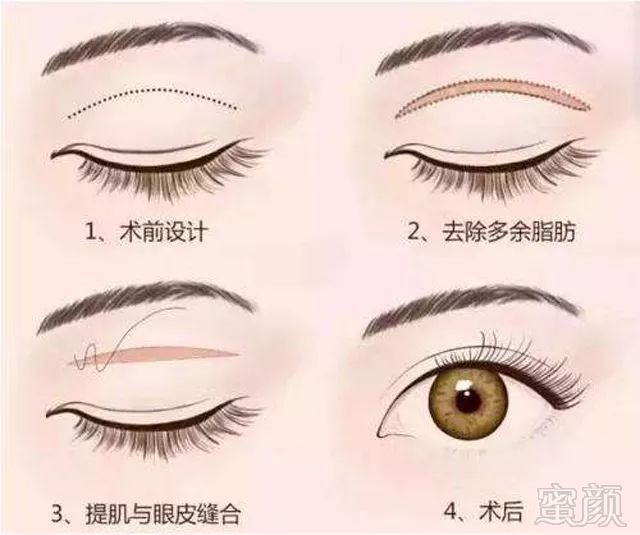 https://img.miyanlife.com/mnt/timg/180108/124144DC-6.jpg
