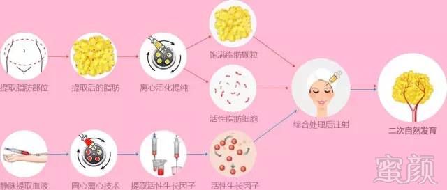 https://img.miyanlife.com/mnt/timg/180108/124940I05-0.jpg
