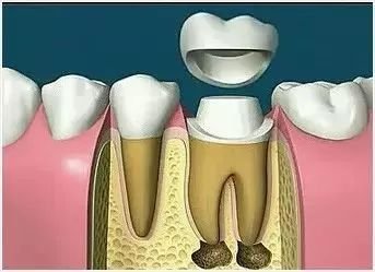 https://img.miyanlife.com/mnt/timg/180108/1331255U5-4.jpg