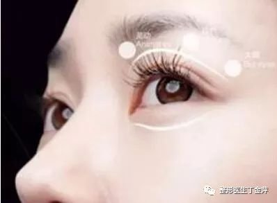 https://img.miyanlife.com/mnt/timg/180109/1022424O1-1.jpg