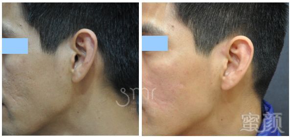 https://img.miyanlife.com/mnt/timg/180109/1100005918-17.jpg