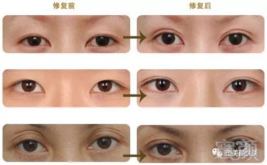 https://img.miyanlife.com/mnt/timg/180109/1159344308-4.jpg
