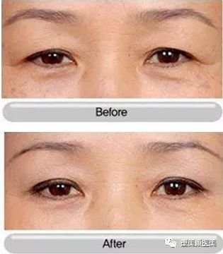 https://img.miyanlife.com/mnt/timg/180109/115934I33-3.jpg