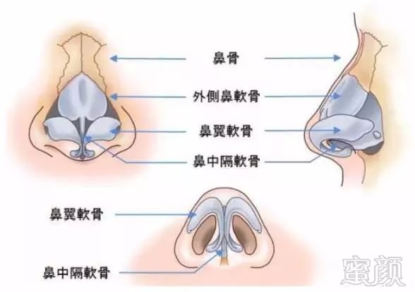 案例图片