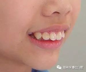 https://img.miyanlife.com/mnt/timg/180109/1301512534-0.jpg