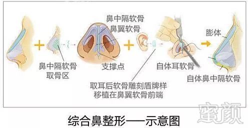 案例图片