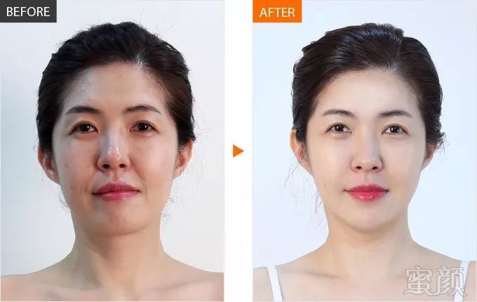 https://img.miyanlife.com/mnt/timg/180109/131325HR-10.jpg