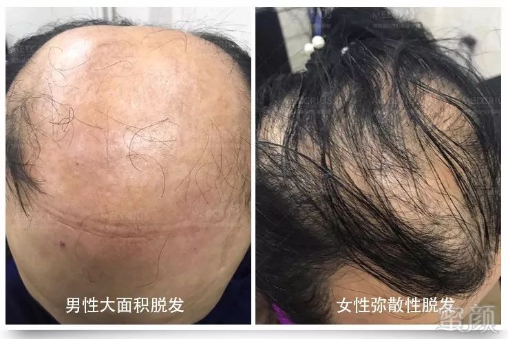 https://img.miyanlife.com/mnt/timg/180109/1315051329-2.jpg