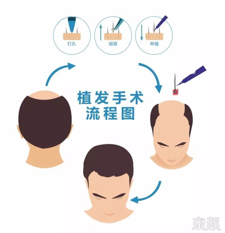 https://img.miyanlife.com/mnt/timg/180109/13150J157-6.jpg