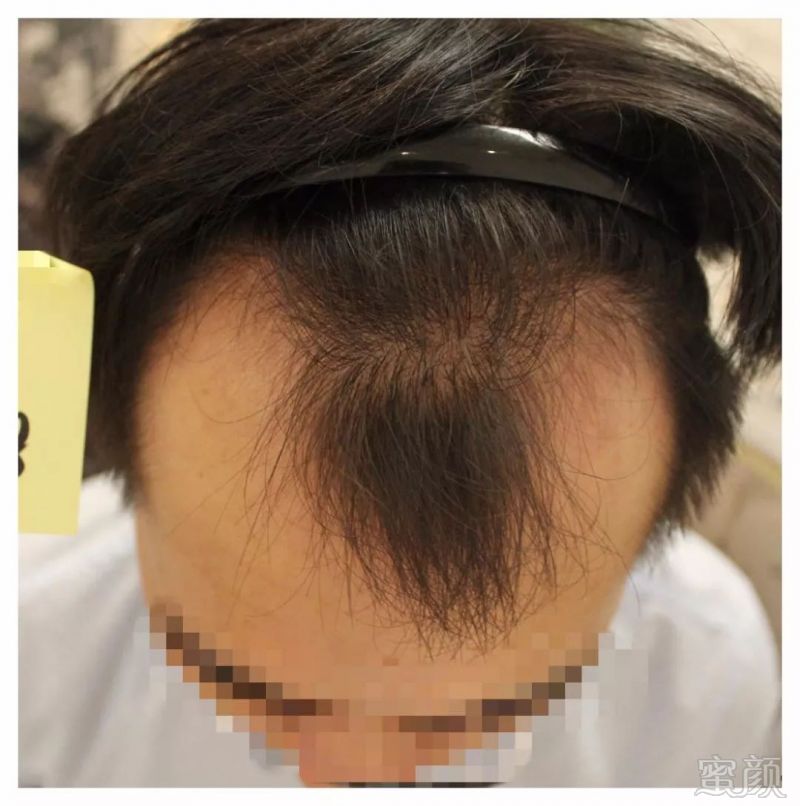 https://img.miyanlife.com/mnt/timg/180109/13150L005-7.jpg